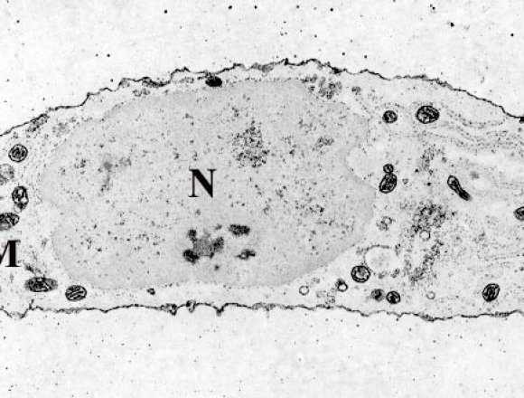 Chondrocyte-_calcium_stain